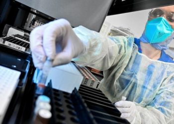 Српски лекар: Луѓе мислат дека имаат стомачен вирус, а всушност се ковид-позитивни