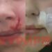 СКАНДАЛ ВО ОСНОВНОТО „ВЛАДО ТАСЕВСКИ“: Седмооделенец расечен на лицето од соученик, директорката крева раменици, потресно сведоштво на мајката (ФОТО)